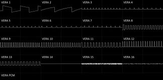 VERA oscilloscope art