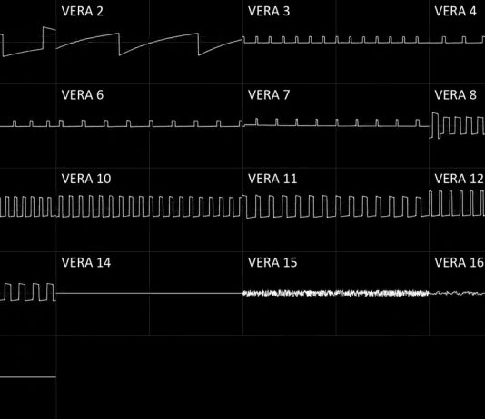 VERA oscilloscope art