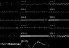 VERA chiptune composition