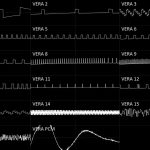 VERA chiptune composition