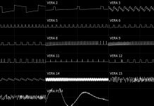 VERA chiptune composition