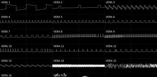 VERA chiptune composition